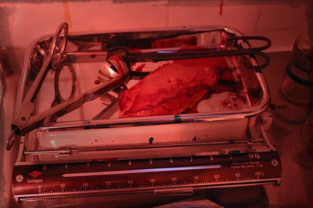 Docteur Ablation scénario Overscape Rouen