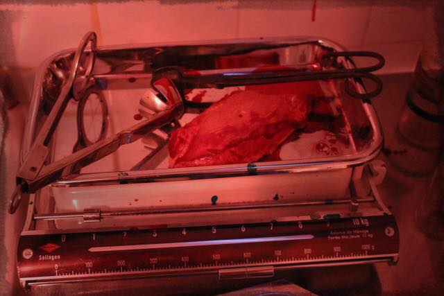 Docteur Ablation scénario Overscape Rouen